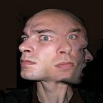 SchizoPhrenia