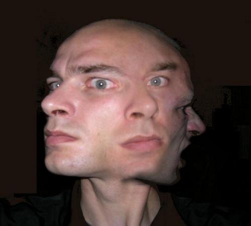 SchizoPhrenia