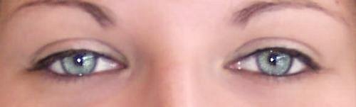 Mes yeux (sans lentilles)