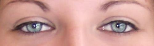 Mes yeux (sans lentilles)