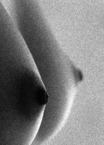 NIPPLES